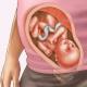 Fotografie a fătului, fotografie a abdomenului, ecografie și video despre dezvoltarea copilului Sarcina 28 săptămâni dezvoltarea bebelușului